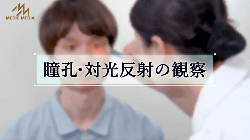 瞳孔・対光反射の観察